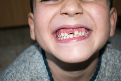 Missing tooth in mouth of a child.