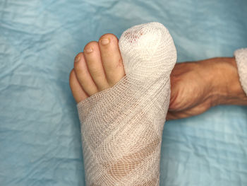 Low section of woman with iv drip