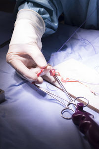 Cropped hand of doctor stitching human body part