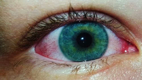 Cropped image of person with red eye