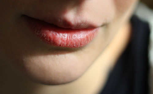 Close-up of woman with dry lip at home