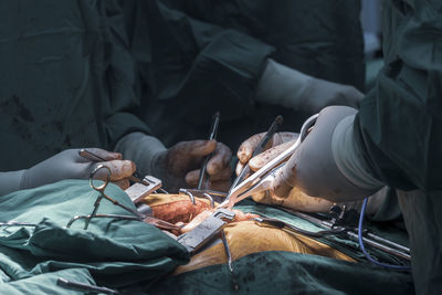 Midsection of doctors operating patient
