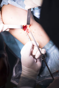 Cropped hand doctor doing knee surgery in operating room