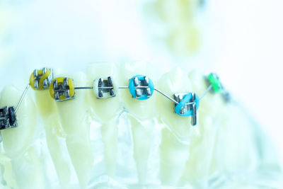 Close-up of dental equipment