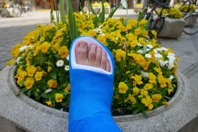 Low section of man with broken leg against yellow flowers