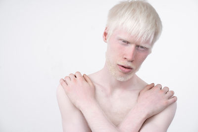 Thoughtful shirtless young man with albino against white background