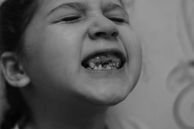 Little girl show broken teeth. girl with a broken and rotten teeth. a large portrait.