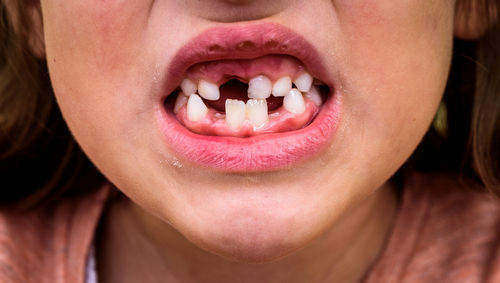 Midsection of girl with gap tooth