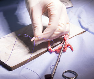 High angle view of cropped hand stitching ligament