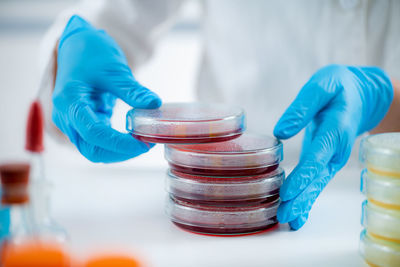 Microbiology lab. hands of a microbiologist, working with bacteria cultures