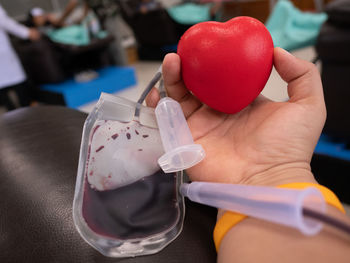 Doctor collect blood from arm of donor, cutting the tube blood bag tube blood extraction donation