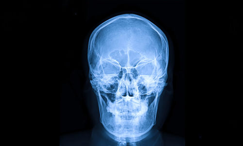 Medical x-ray of human head against black background