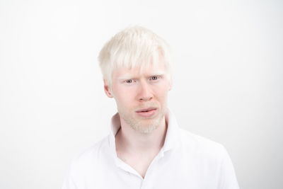 Portrait of young man with albino against white background
