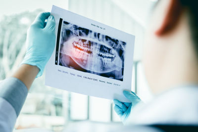 Cropped image of dentist examining x-ray