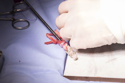 Cropped hand of surgeon doing surgery in hospital