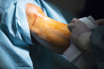 Cropped hand of surgeon operating patient at hospital