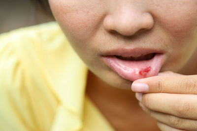 Close-up of woman with hands