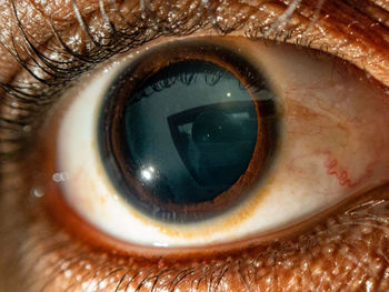 Close-up of human eye