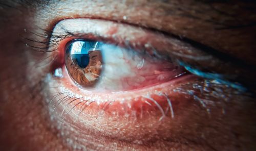 Close-up of human eye