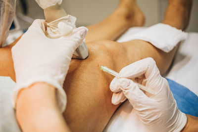 Detail on the hands of a doctor wearing gloves doing an ultrasound test on the legs of a patient lying on a stretcher in the hospital