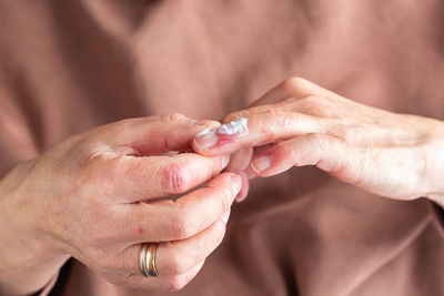 Elder woman applying cream or ointment to her hands with atopic dermatitis, eczema, allergy reaction