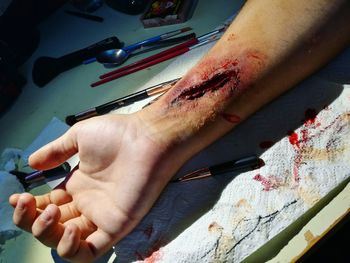 Close-up of injured hand on table