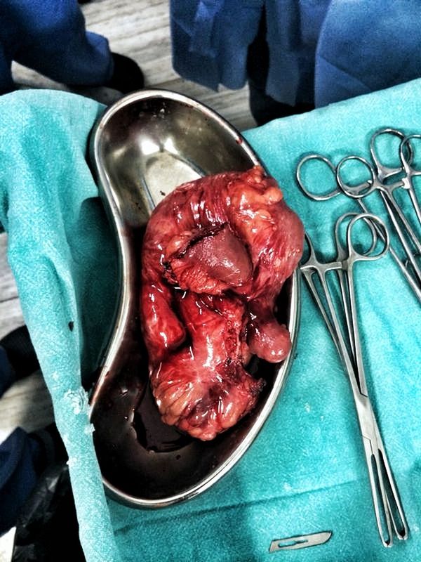 LOW SECTION OF MAN WITH MEAT ON TABLE