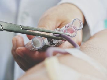 Close-up of healthcare worker taking blood sample