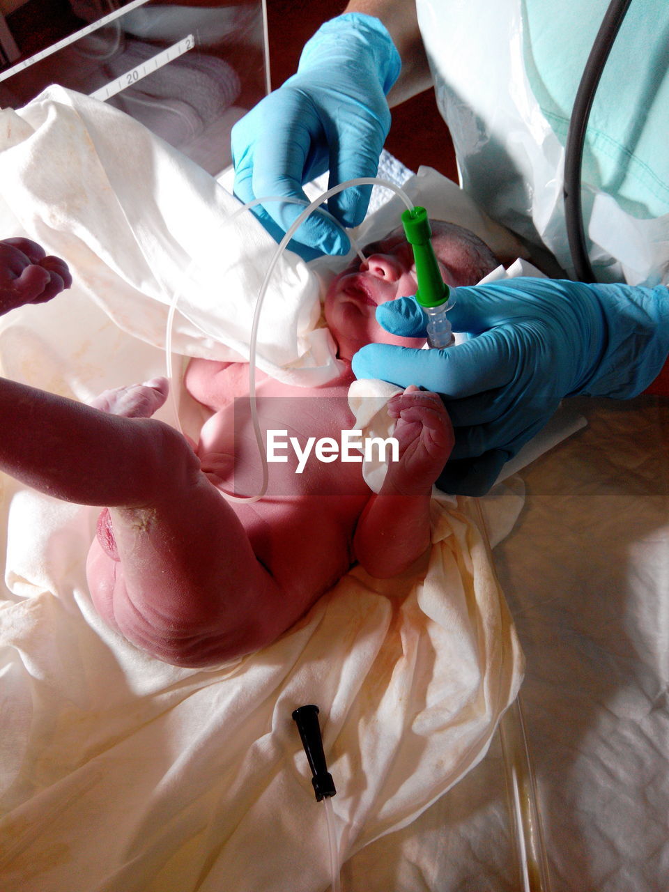Midsection of doctor inserting nasogastric tube in newborn nose at hospital