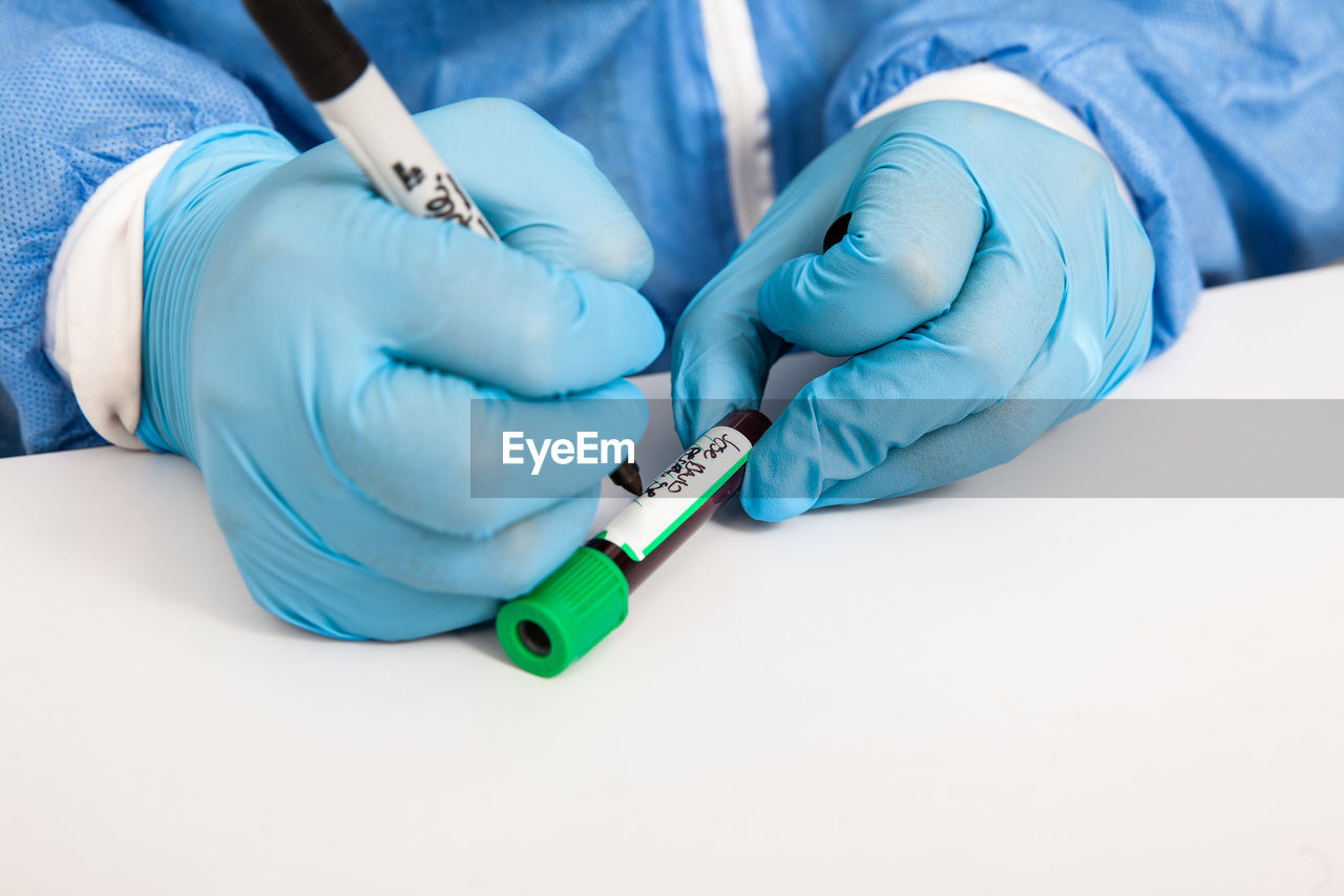 Closeup of a nurse labelling a test tube with blood sample in a clinical laboratory