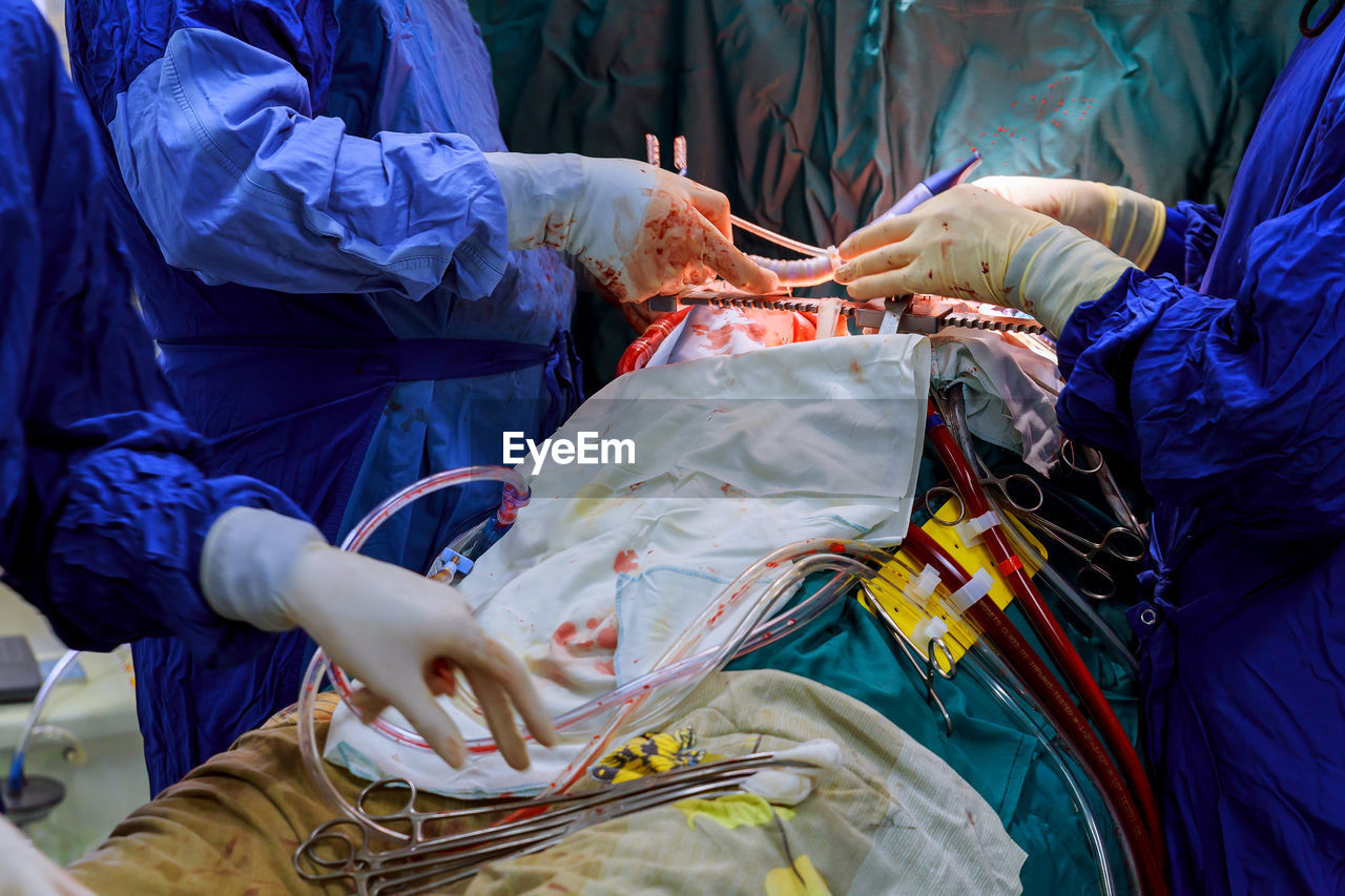 Midsection of doctors performing operation on patient in operating room