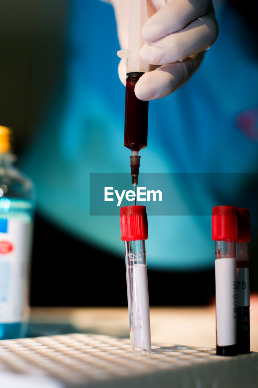 Midsection of doctor examining blood sample in test tube