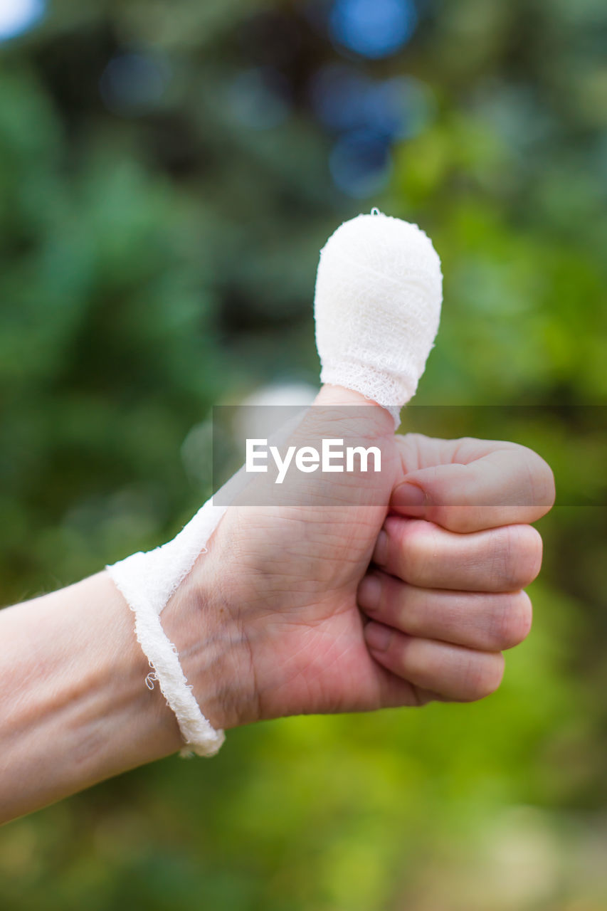 Cropped image of injured hand gesturing thumbs up sign outdoors