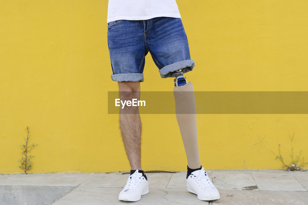 Man with disability standing on street