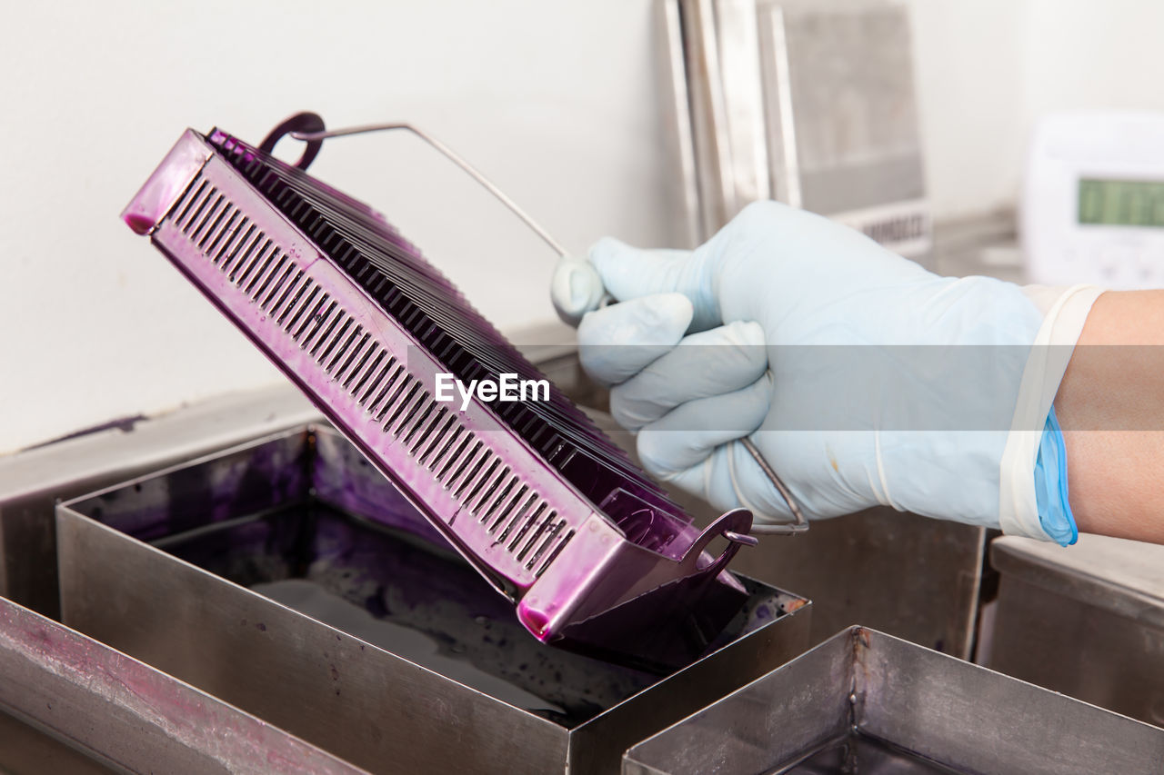 Scientist staining microscope slides for cytology studies in the laboratory.