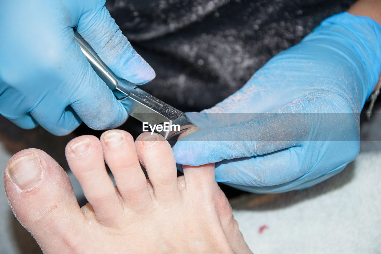 Pedicure master removes dead skin from the client's feet using medical nippers