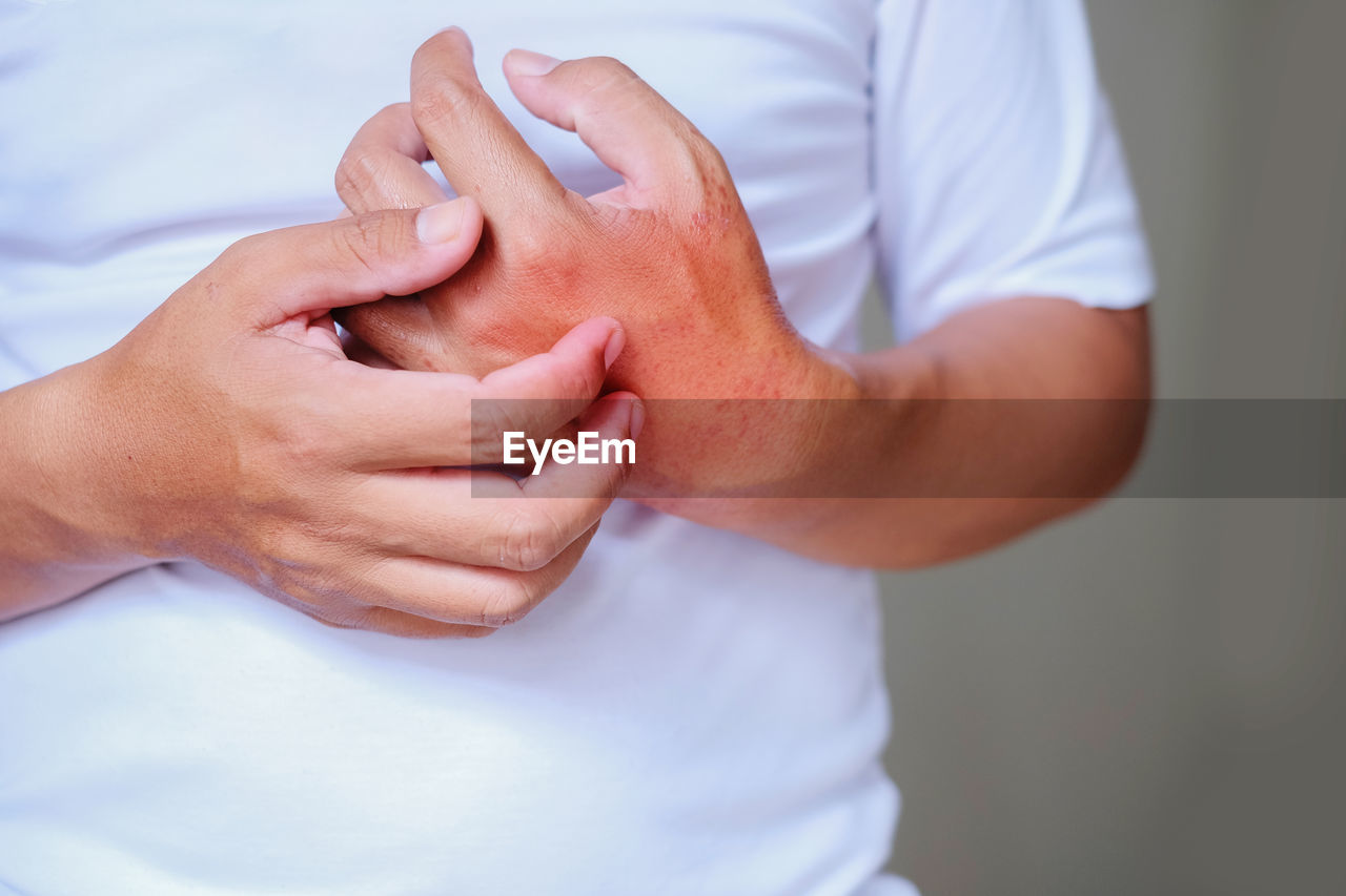 CLOSE-UP OF HANDS HOLDING FINGER