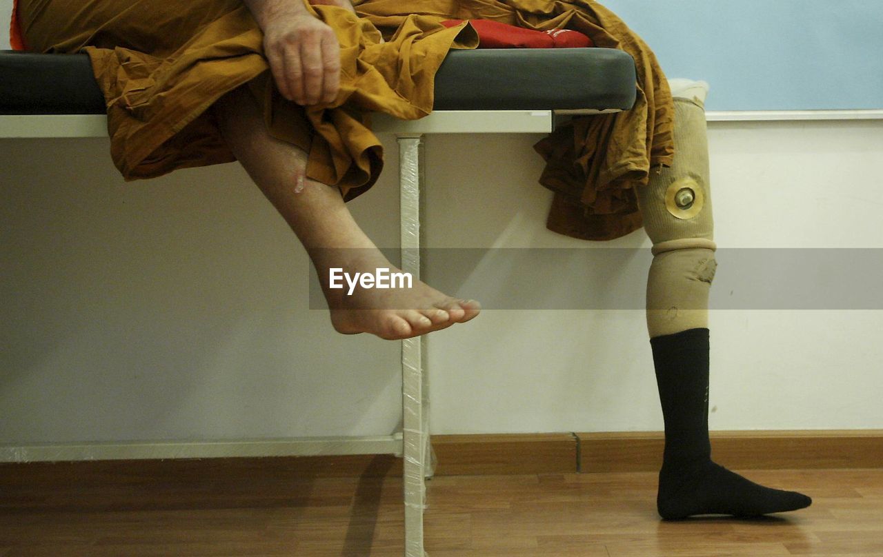Patient using prosthetic leg