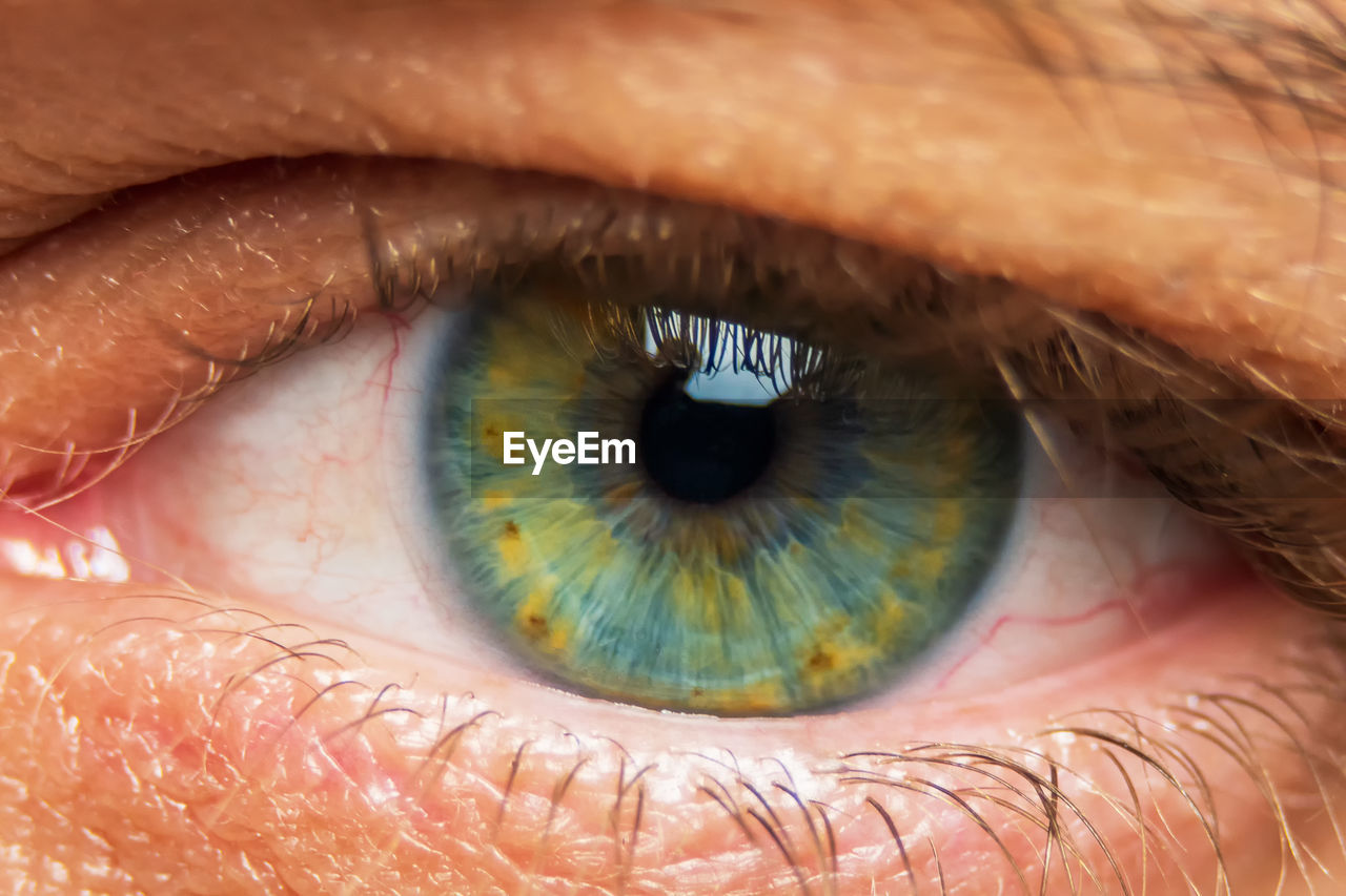 A human eye in a contact lens in close-up. the blue iris is surrounded by red capillaries