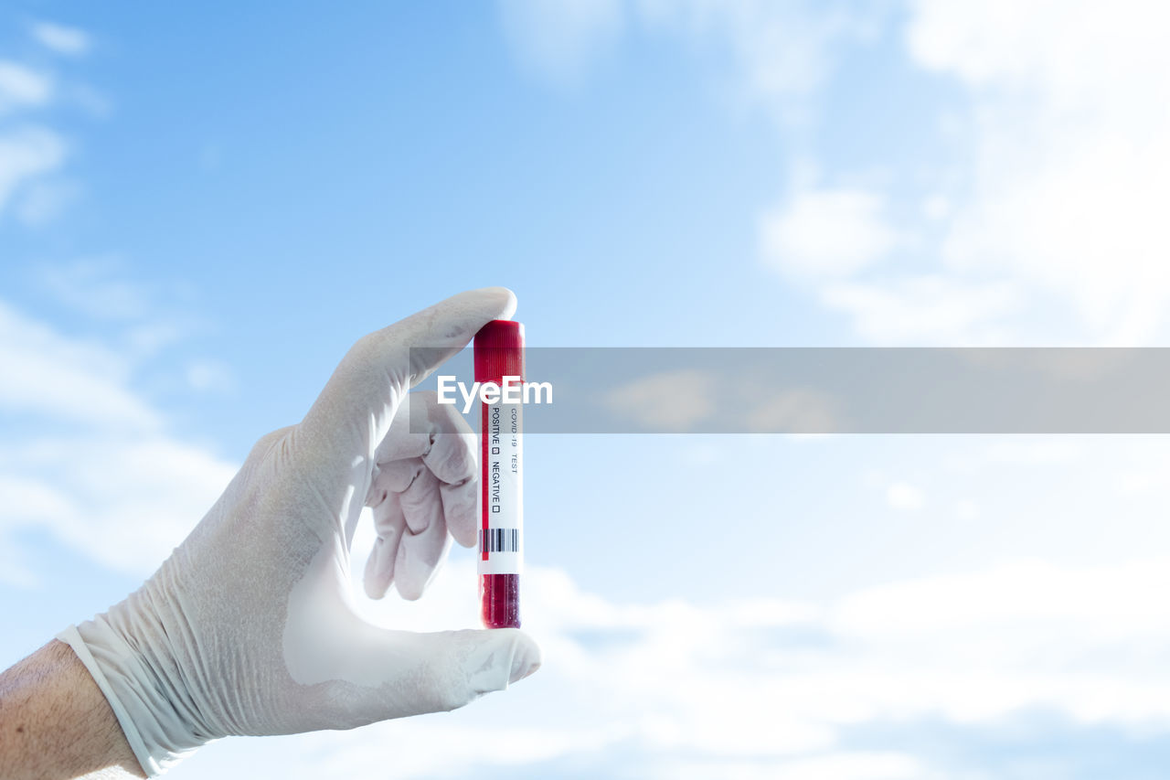Doctor's hand shows a positive result of the coronavirus, new york uni