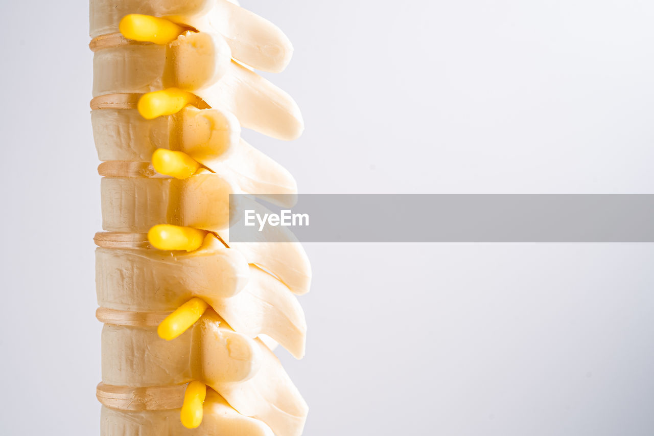 yellow, studio shot, food and drink, food, indoors, pill, healthy eating, healthcare and medicine, no people, dose, plant, copy space, wellbeing, produce, large group of objects, still life, medicine, white background, freshness, vitamin, cut out, close-up, capsule, corn kernels, nutritional supplement, abundance
