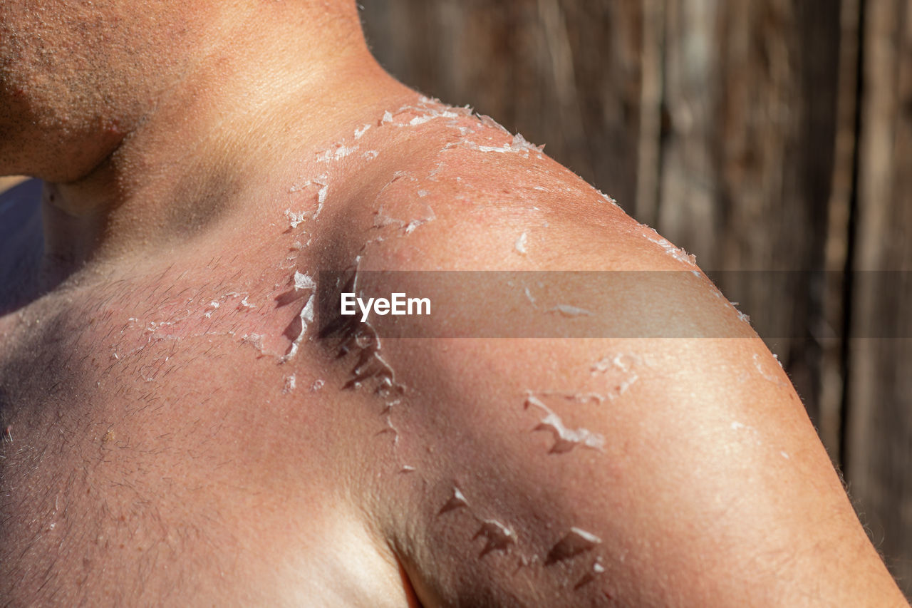 skin, close-up, adult, relaxation, human skin, one person, lifestyles, water, body care, skin care, wet, nature, limb, women, human face, human leg, exfoliation, nose, leisure activity, young adult, human mouth, summer, holiday, vacation, hand, trip, sunlight, land, outdoors, drop, midsection, wellbeing, healthcare and medicine