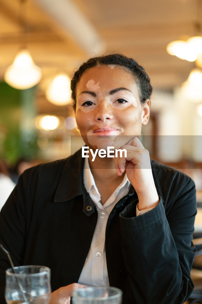 Portrait of young woman with vitiligo sitting in restaurant