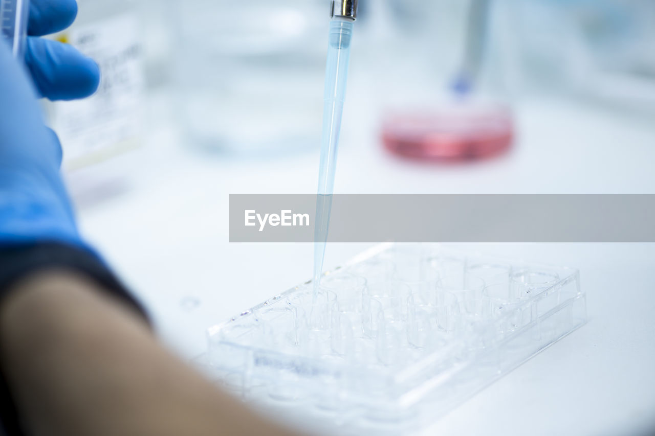 cropped hand of scientist examining chemical in laboratory