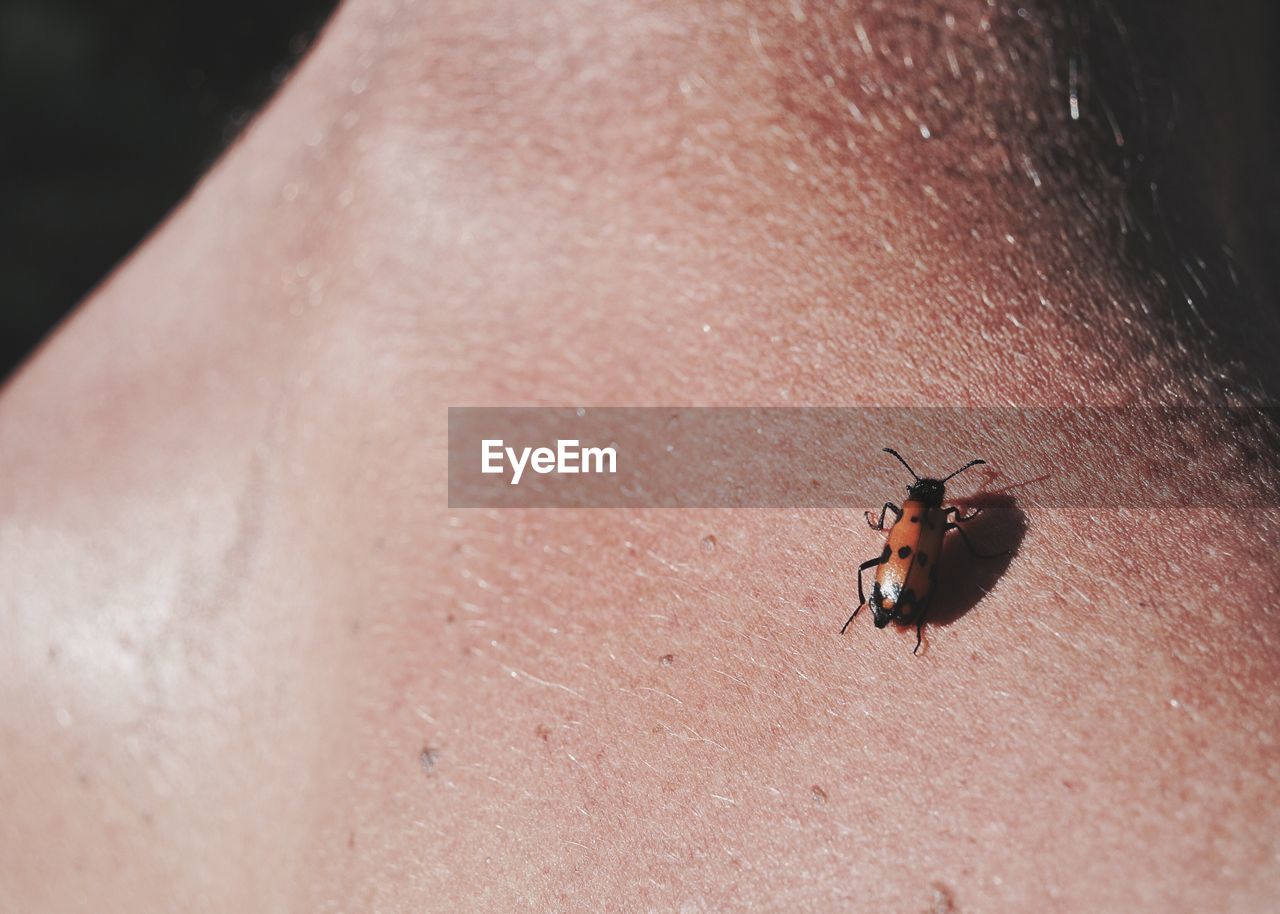 Close-up of insect on human neck
