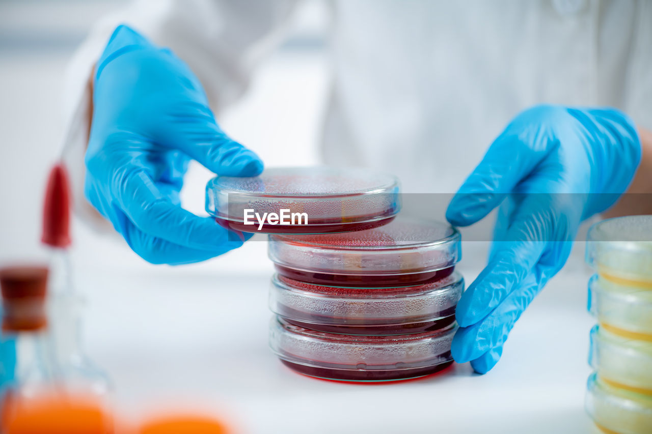 Microbiology lab. hands of a microbiologist, working with bacteria cultures