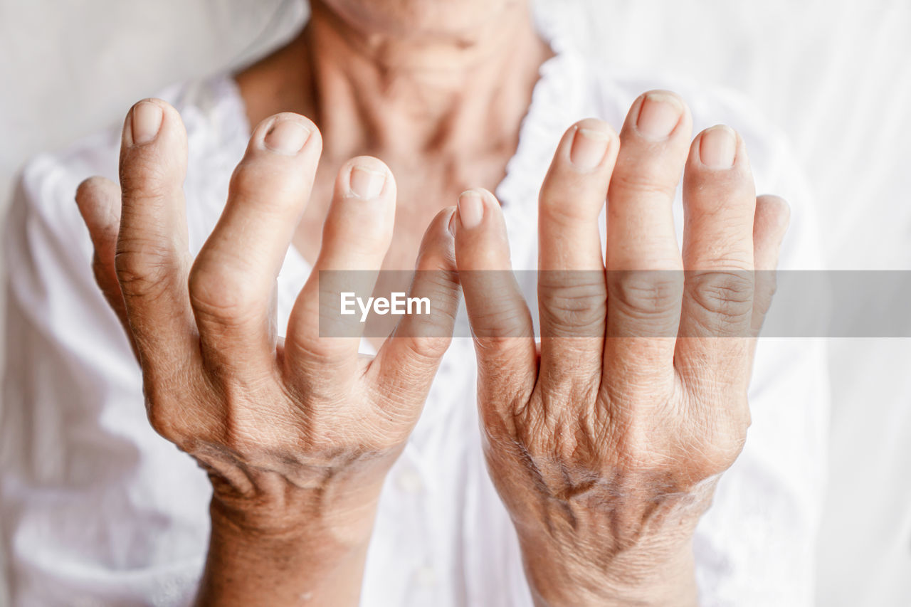 Close-up of senior woman with wrinkled fractured hands