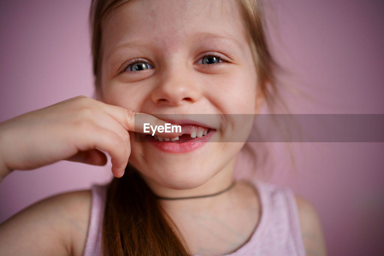 Girl smiles without a front tooth