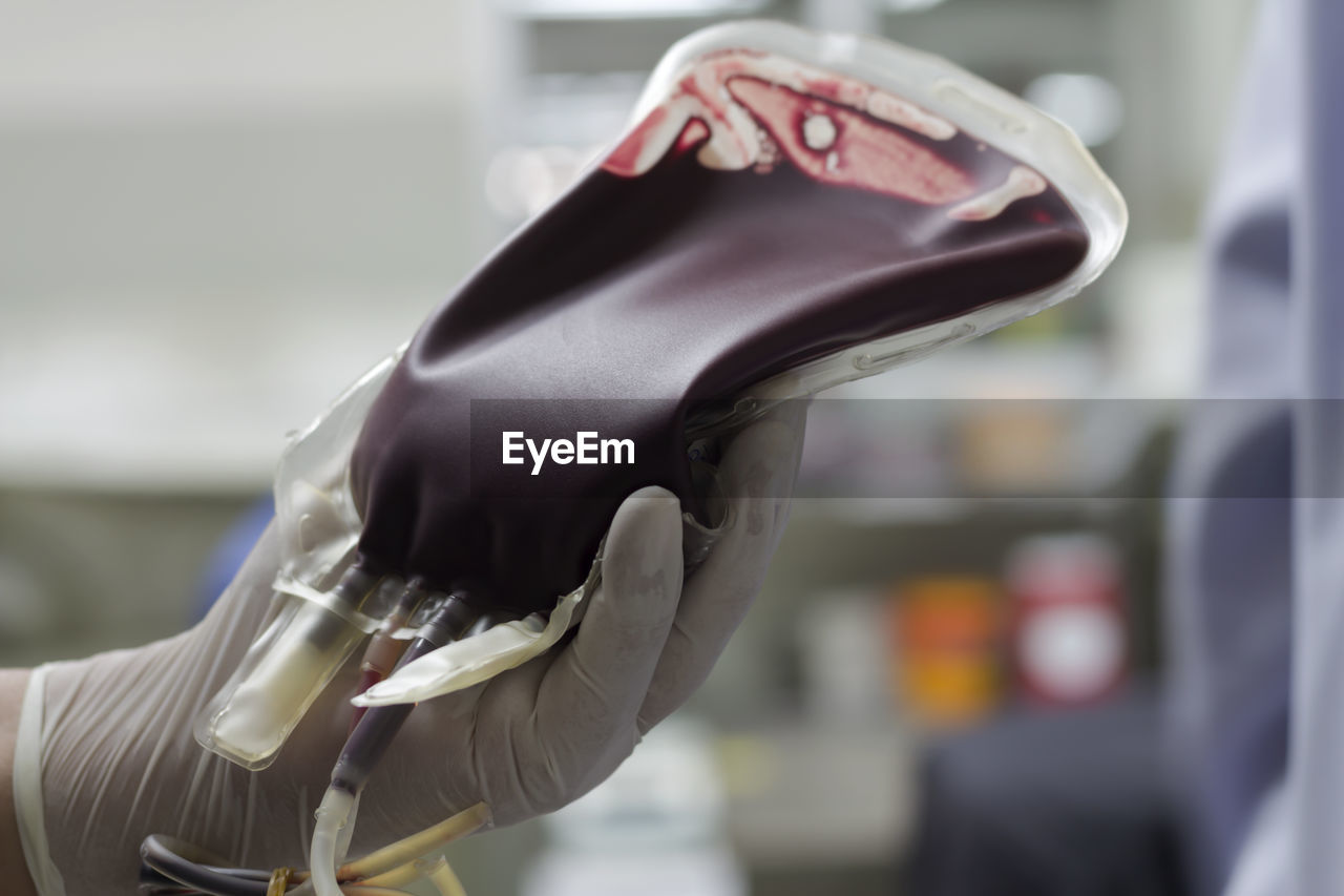 Cropped hand of doctor holding blood bag