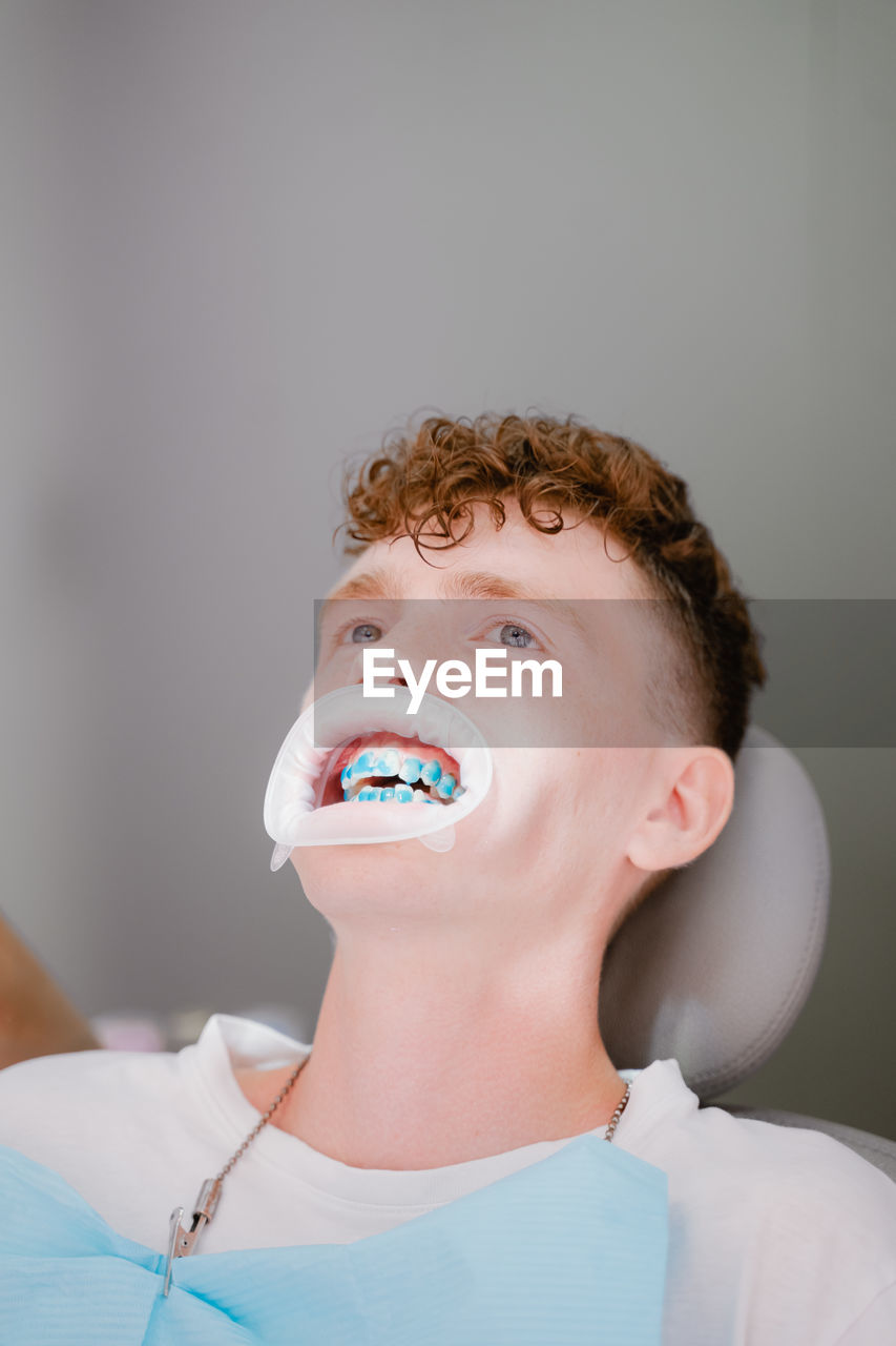 Guy with curly hair sits in the dentist's chair with whitening gel on his teeth